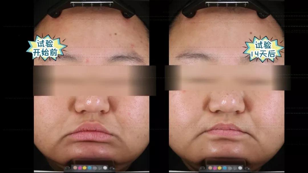 44